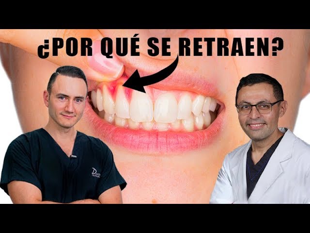 porque se retraen las encias y como evitarlo