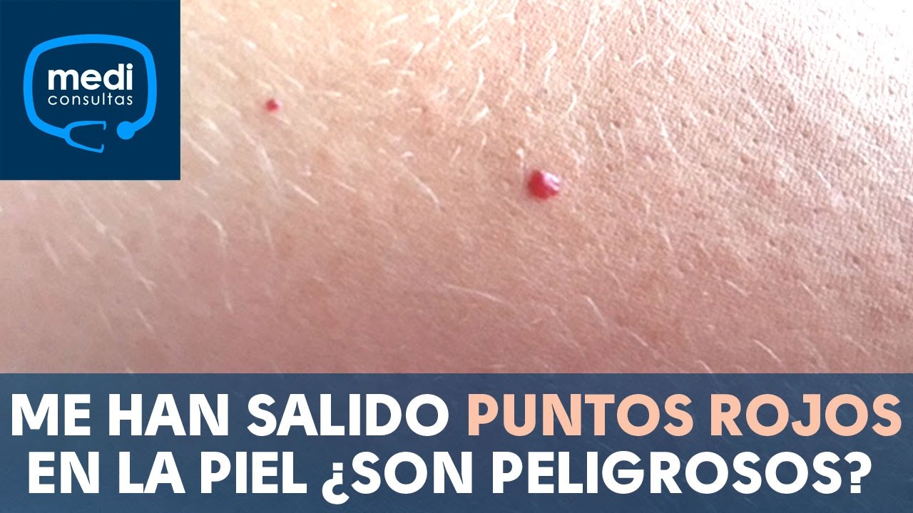 puntos rojos en la boca en adultos