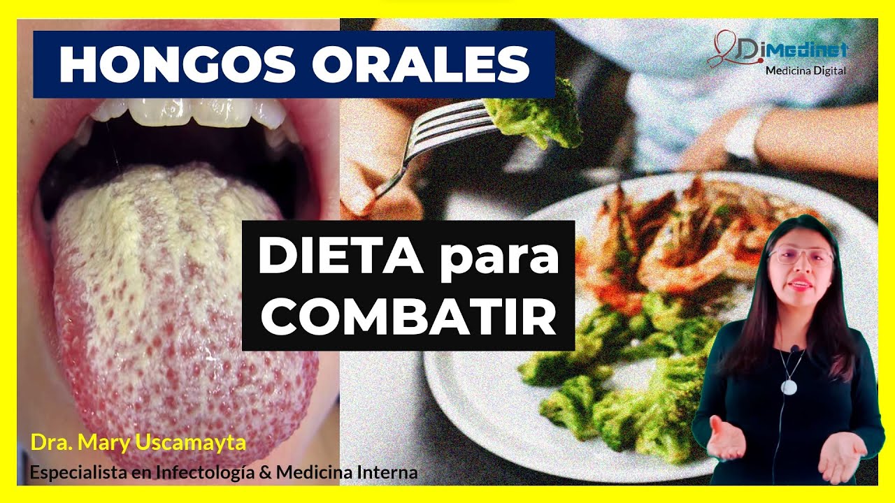que comer con hongos en la boca