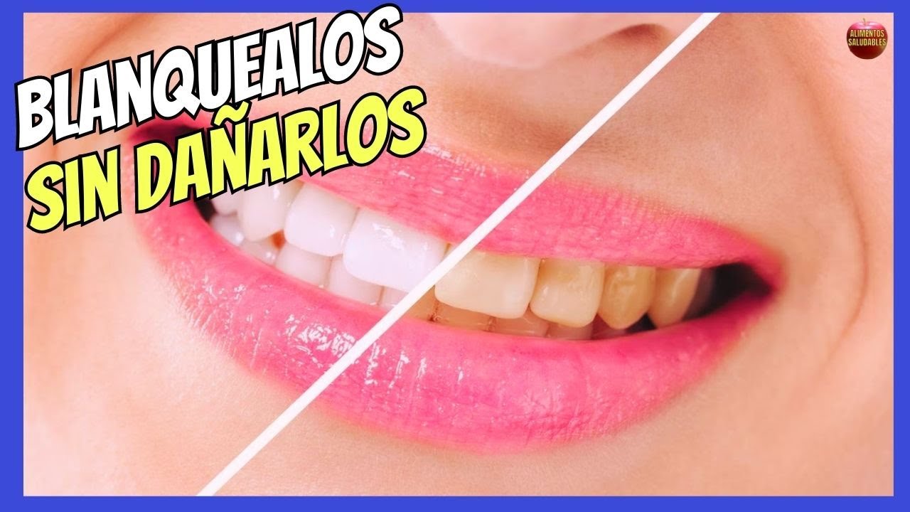 remedios caseros para blanquear los dientes amarillos