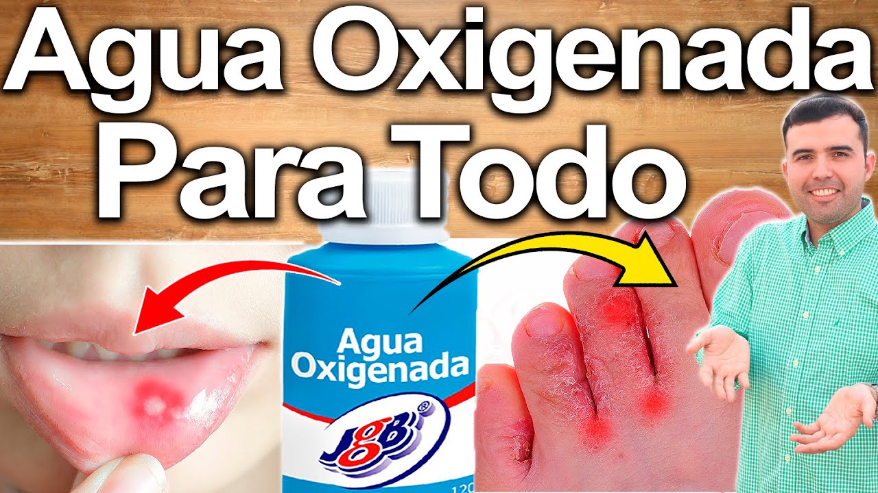 agua oxigenada al 3 por ciento
