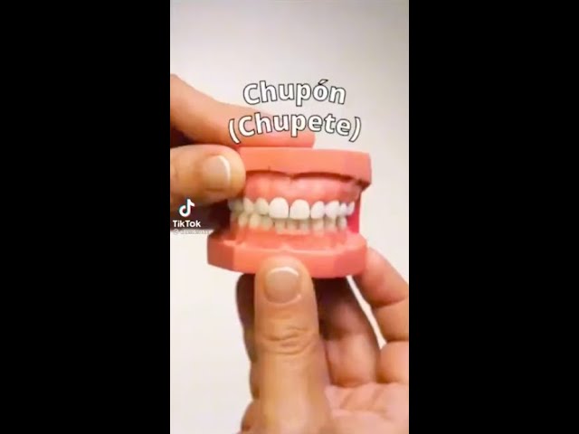 chupetes que no deforman los dientes