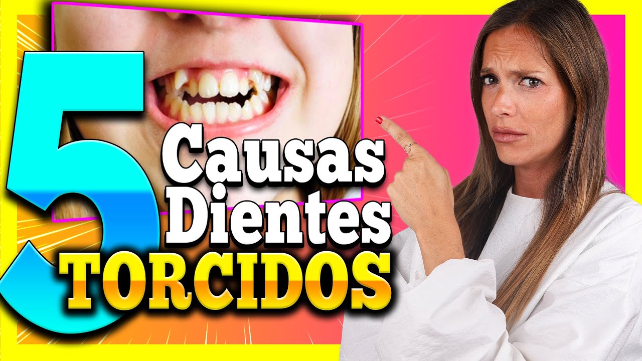 como evitar que los dientes salgan torcidos