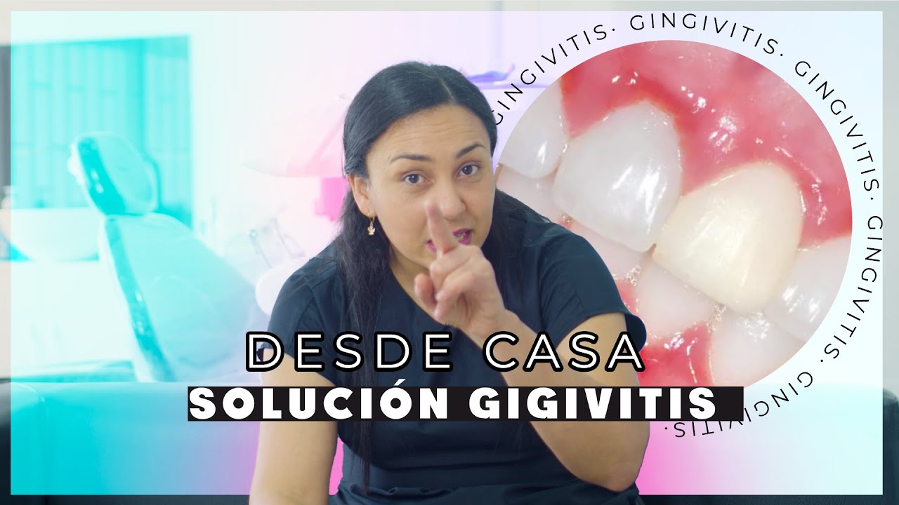 como quitar la gingivitis de los dientes rapido