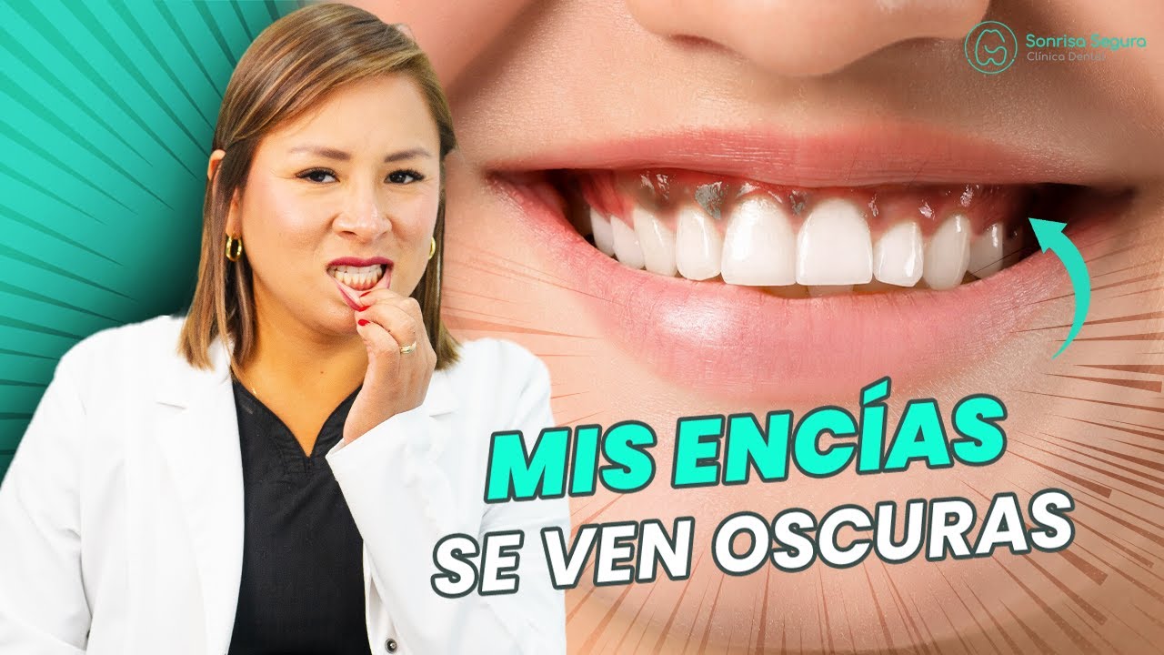 como quitar lo negro de las encias
