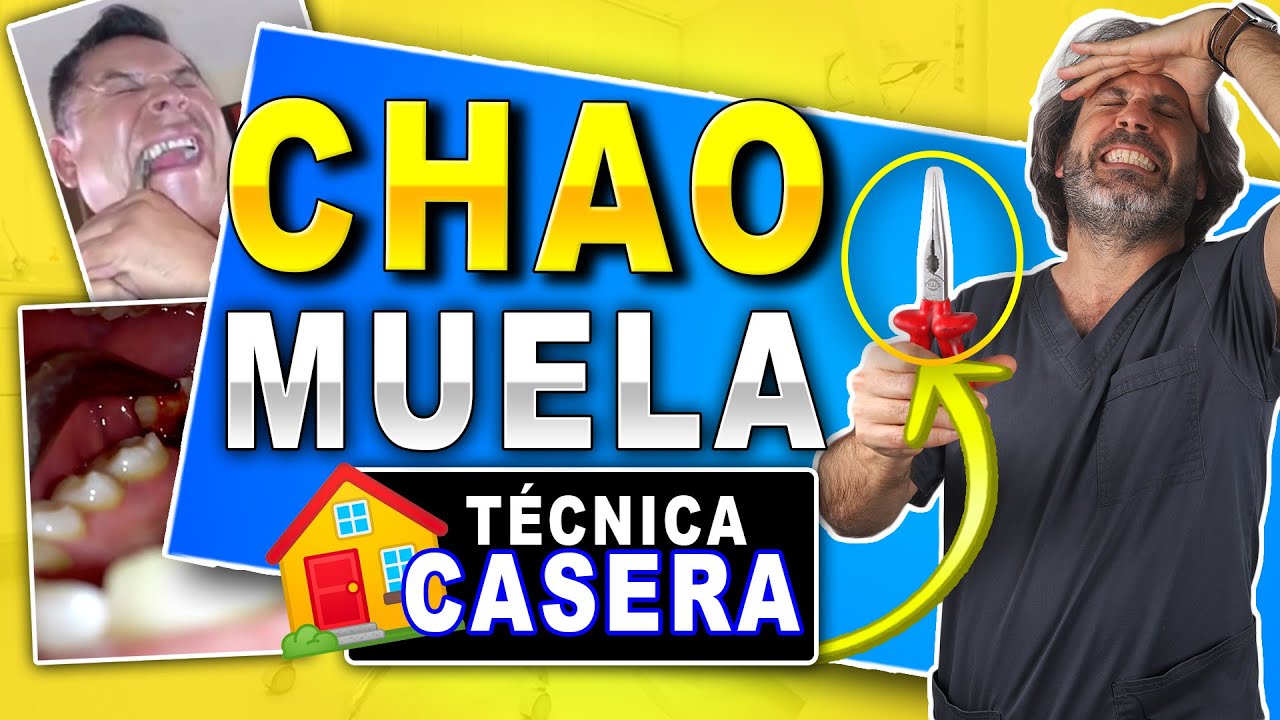 como sacar un diente en casa sin dolor