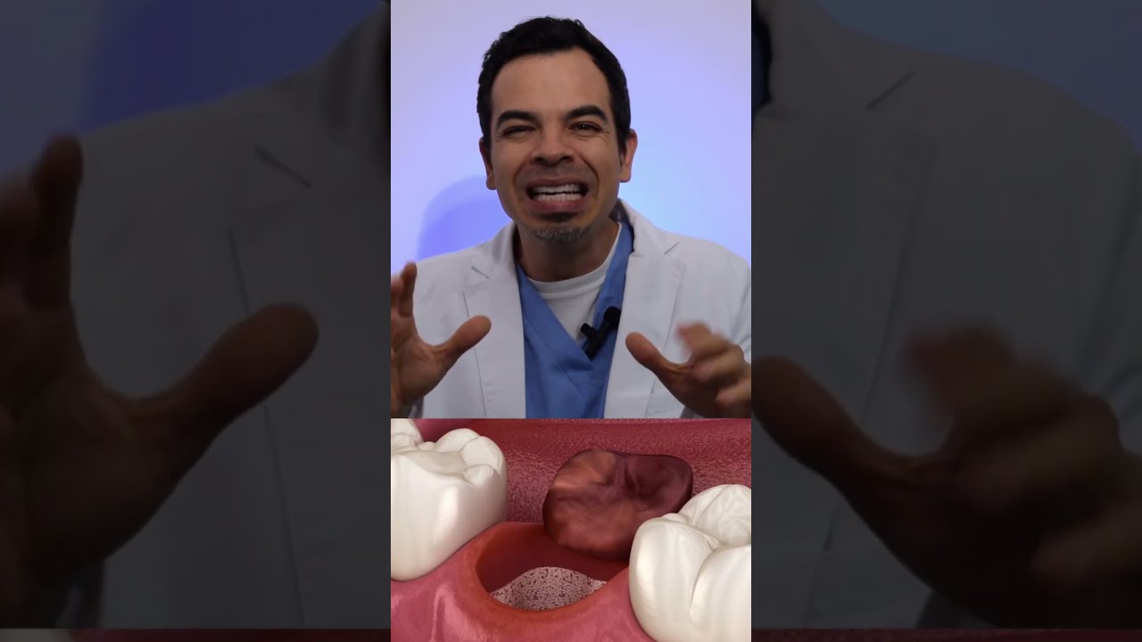 cuantas extracciones dentales se pueden hacer en un día