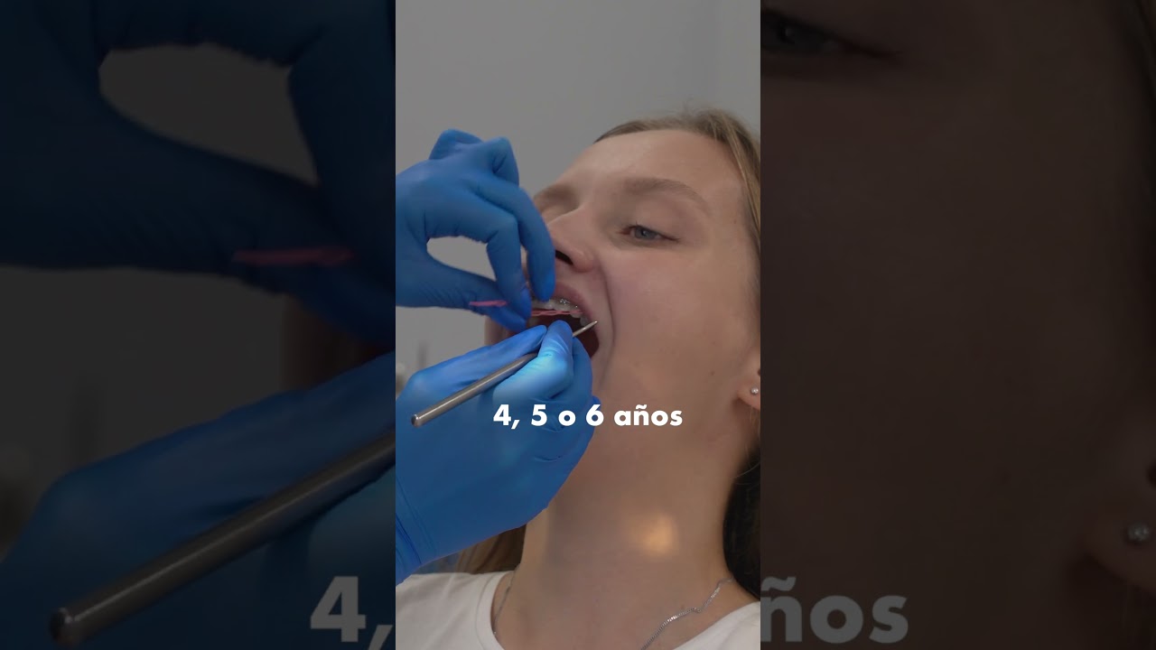 cuanto cuesta quitarse los brackets en españa