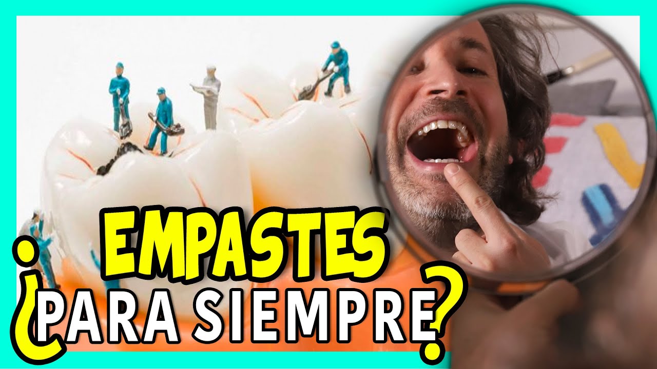 cuanto se tarda en empastar una muela