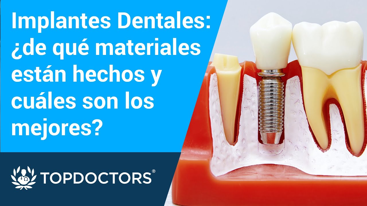 de que material son los implantes dentales