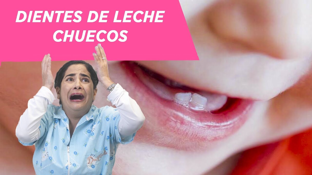 dientes chuecos en bebes de un año