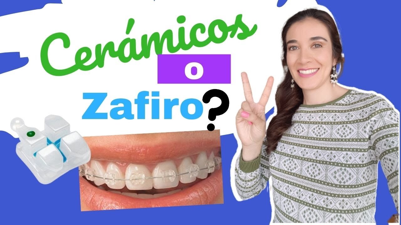 diferencia entre brackets esteticos y de zafiro