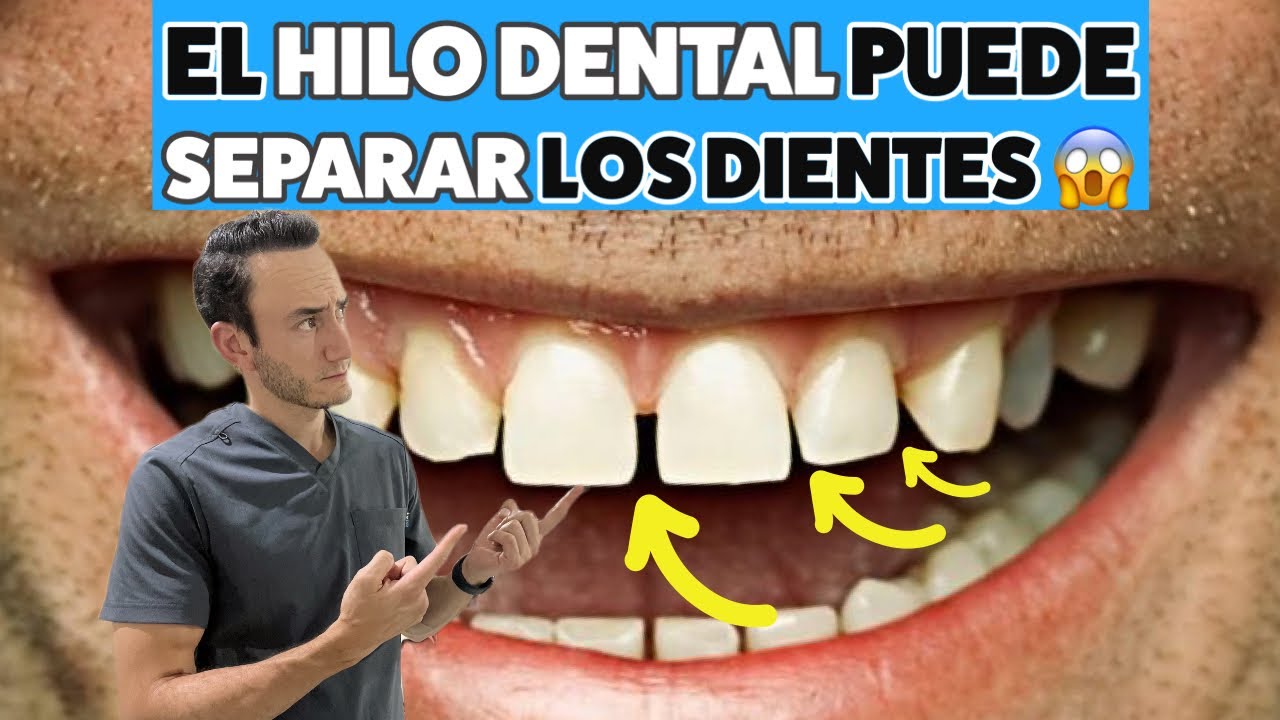 el hilo dental separa los dientes