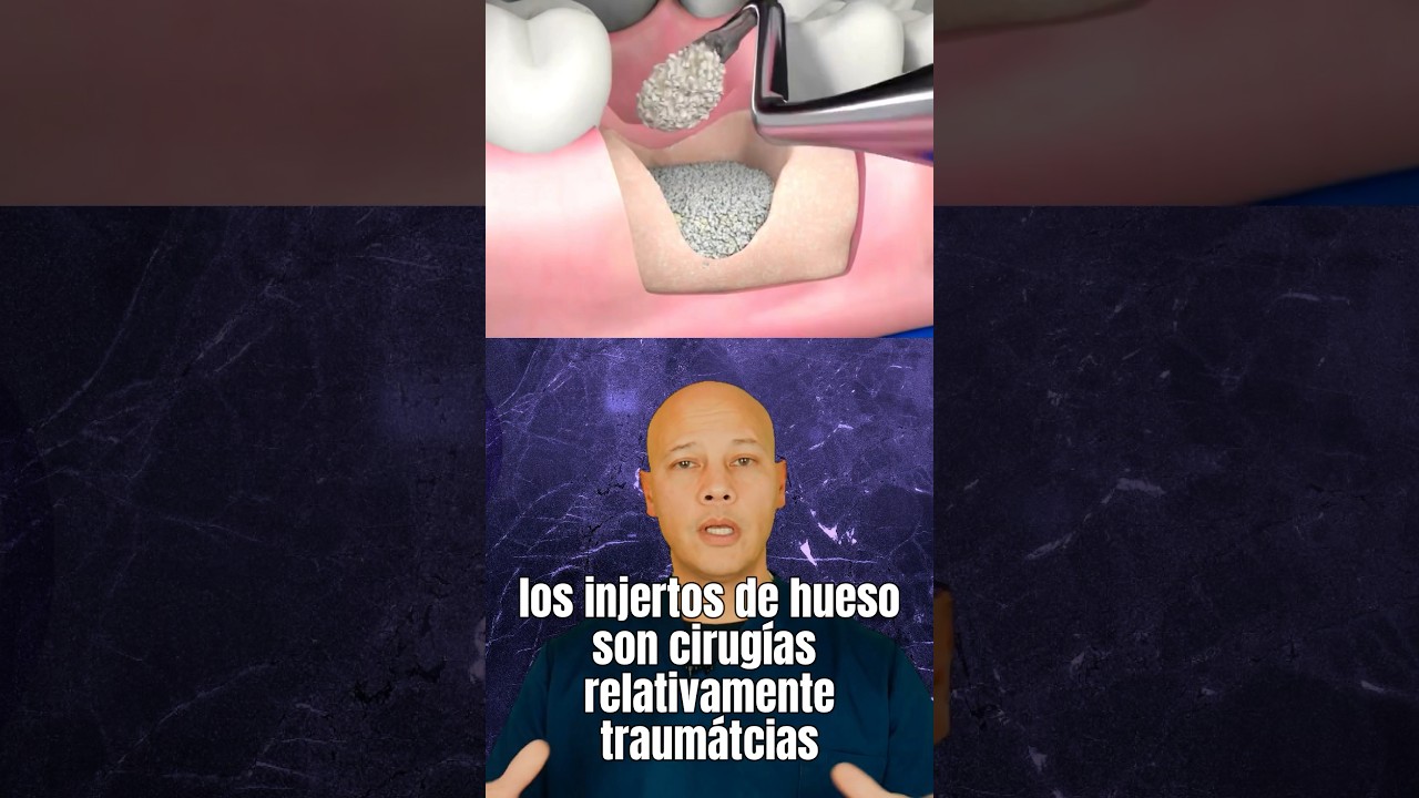 es doloroso el injerto de hueso dental