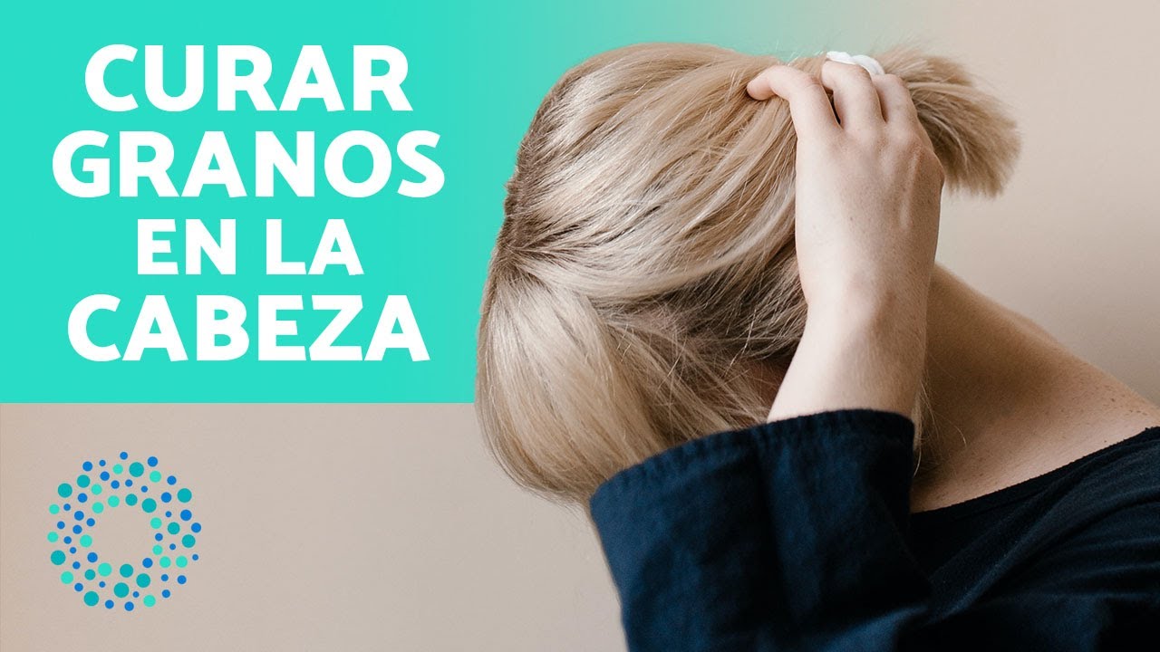 granos en la cabeza por estres