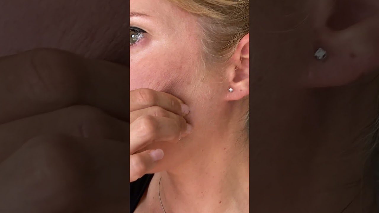 inflamacion en la zona de la mandibula
