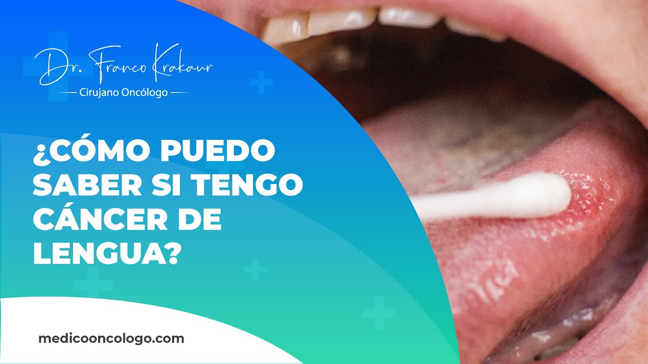 manchas rojas debajo de la lengua