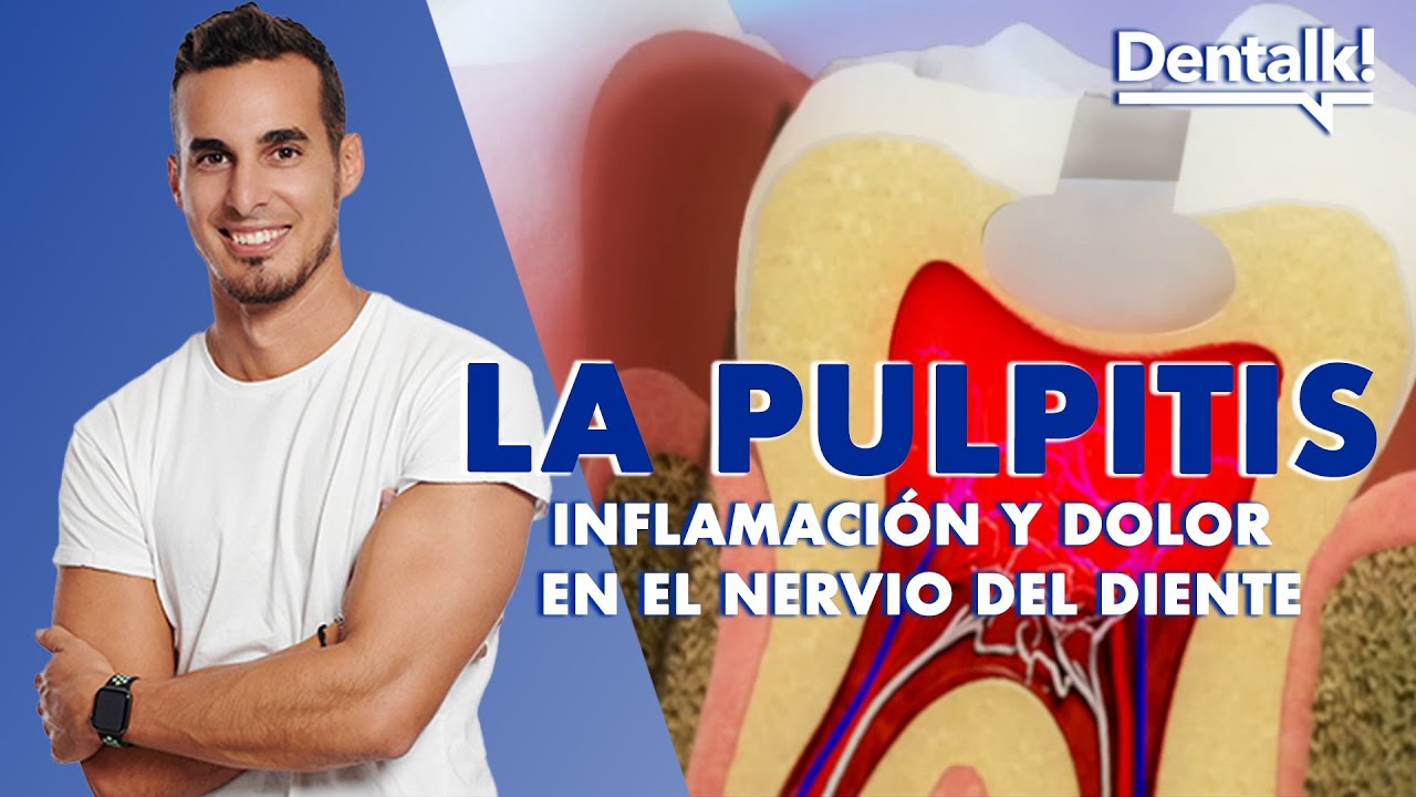 matar el nervio de una muela duele