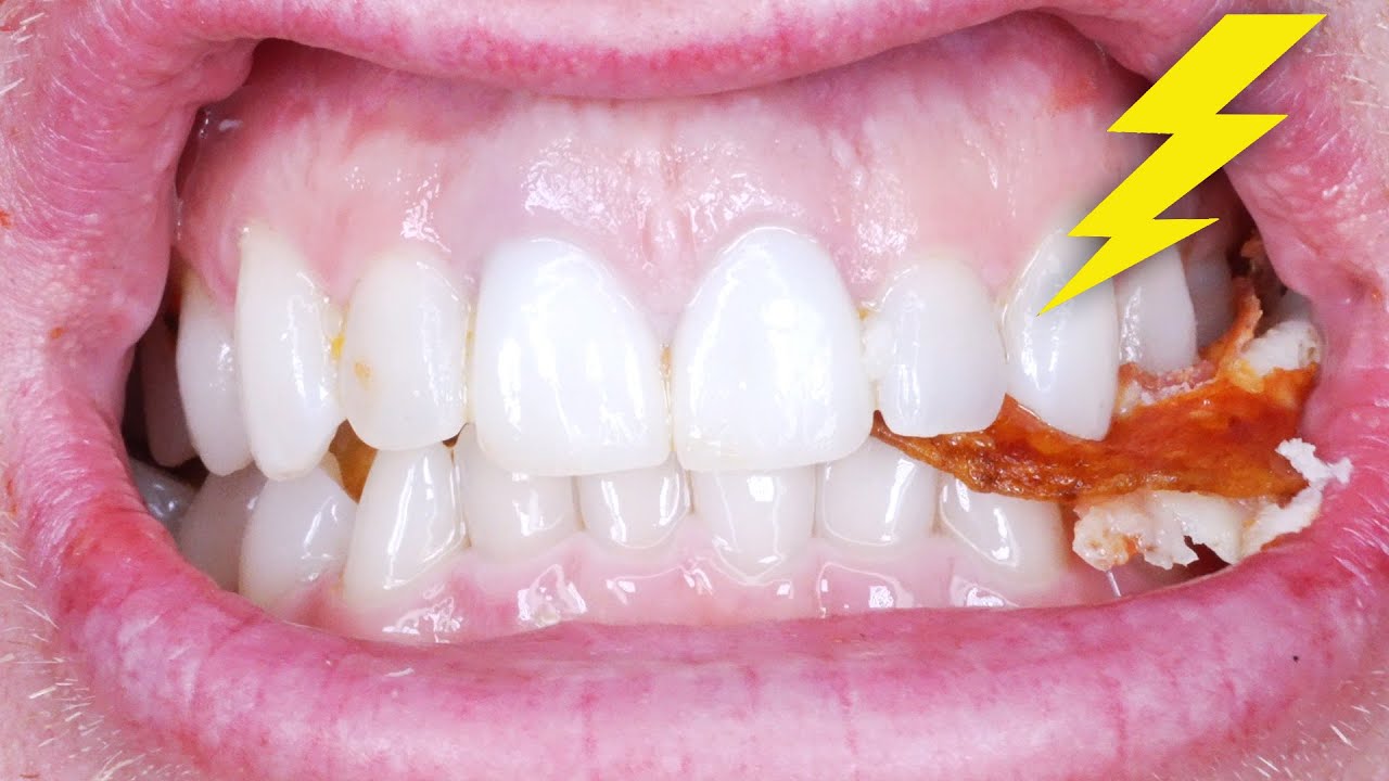 pain when i bite down on tooth