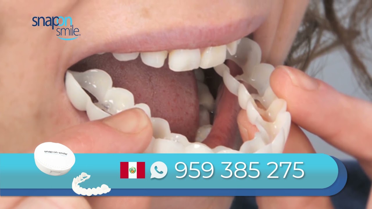 poner fundas en los dientes precio
