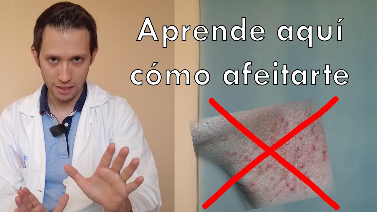 por que salen granos en la barbilla