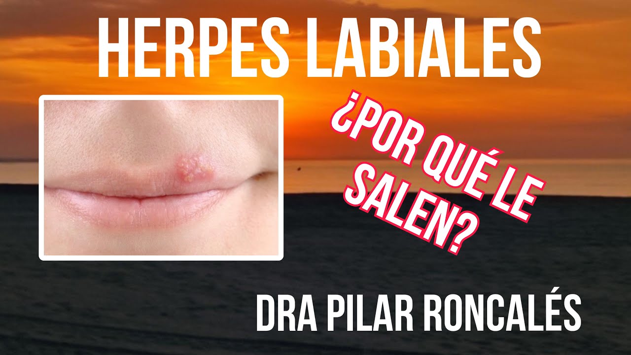 por que salen herpes en los labios