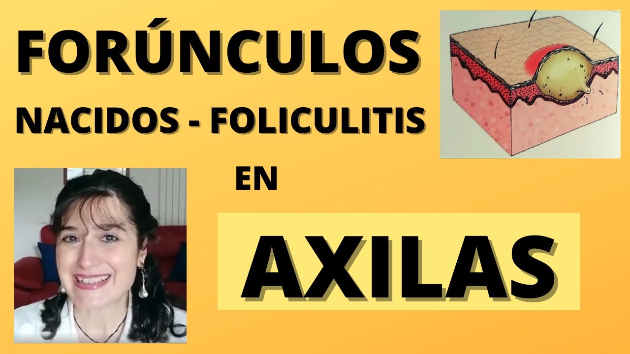 porque me salen granitos en las axilas