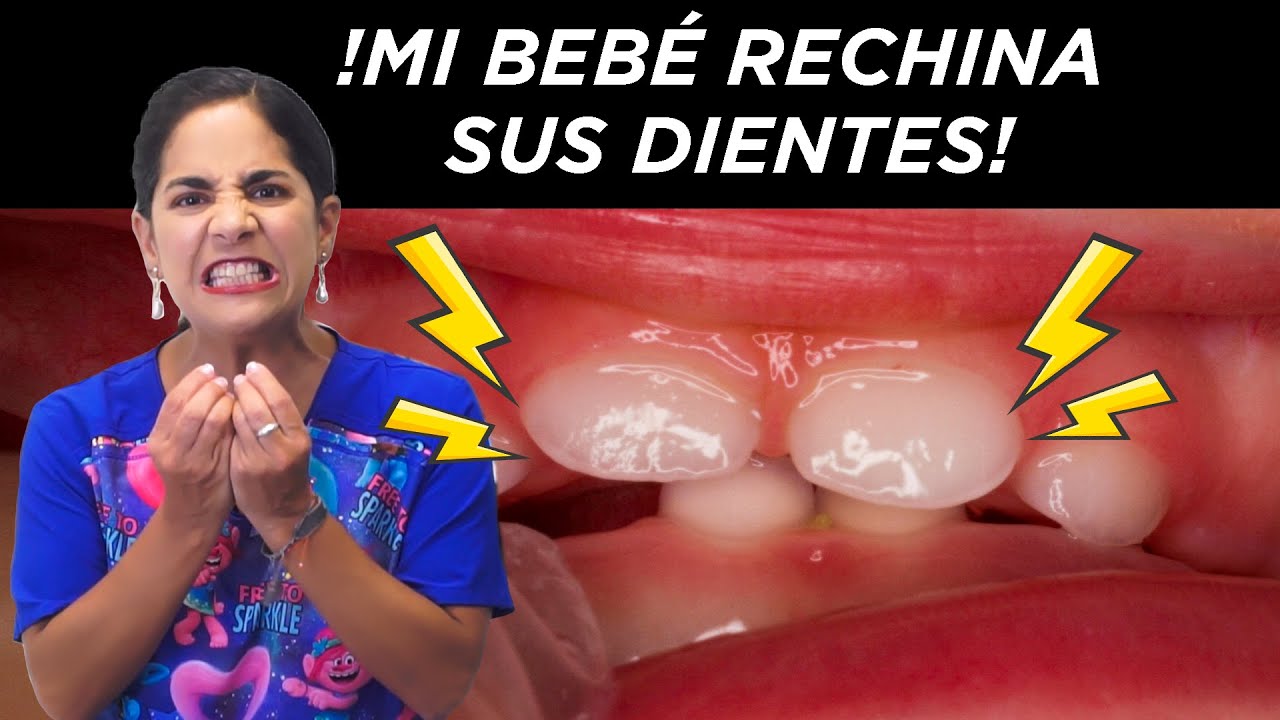 porque rechinan los dientes los bebés de un año