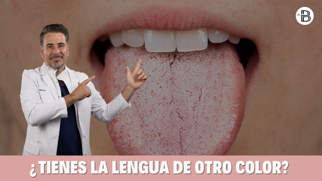 q pasa si tengo la lengua blanca