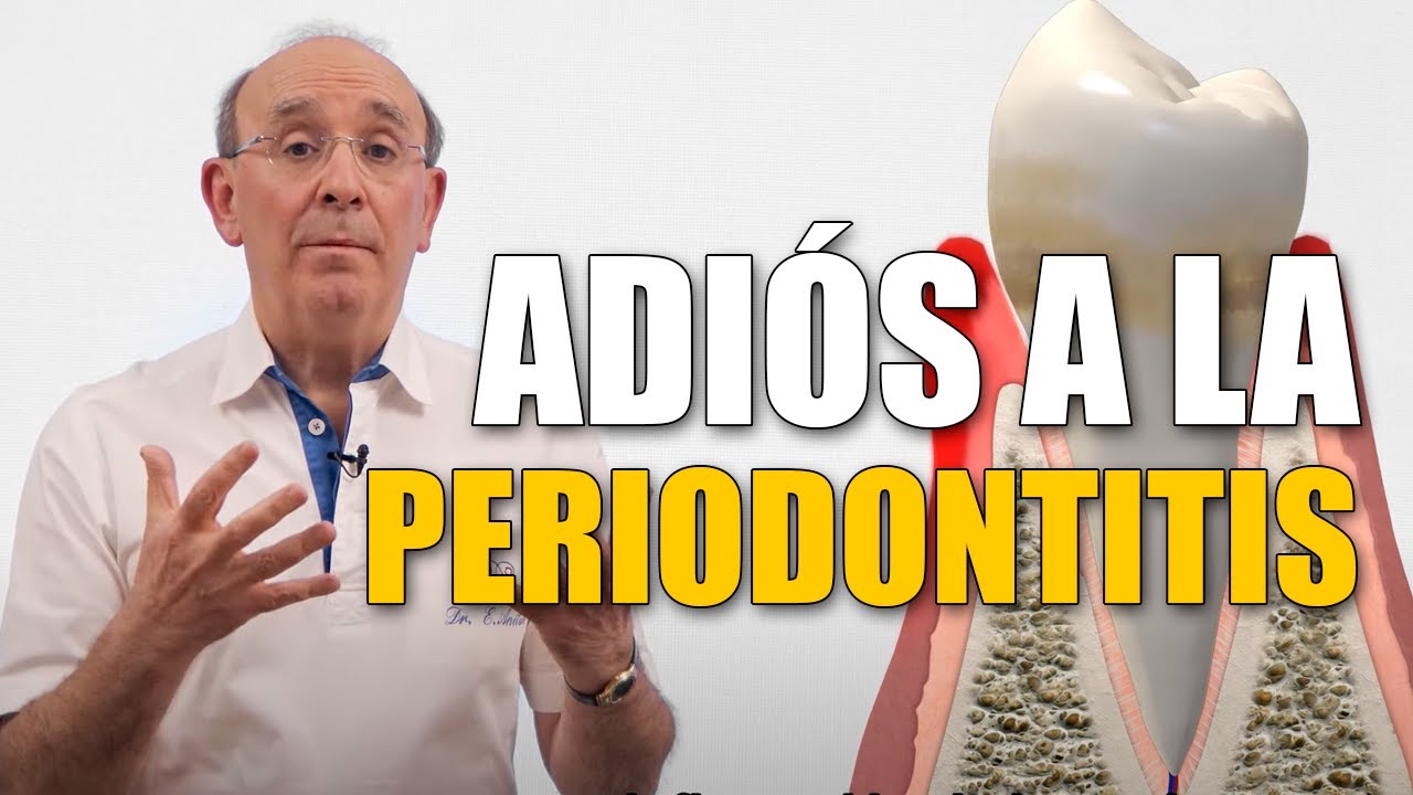 qué es la piorrea en los dientes