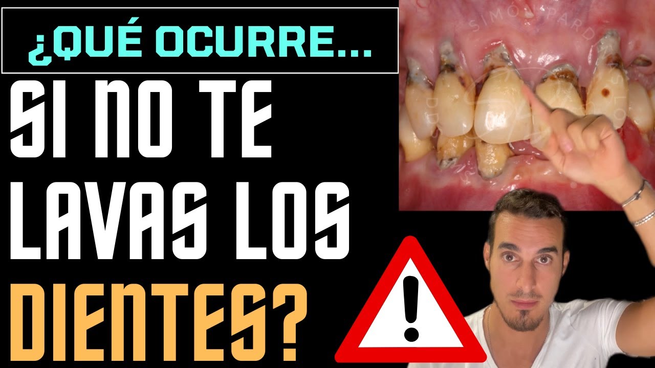 que pasa si no me lavo los dientes