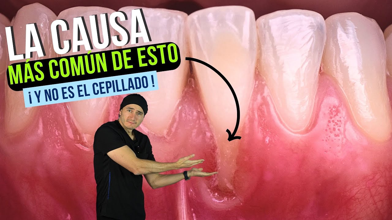 que recubre la raiz de los dientes