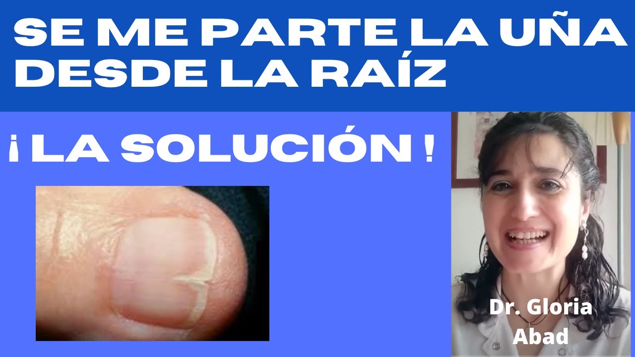 una rota por la mitad vertical