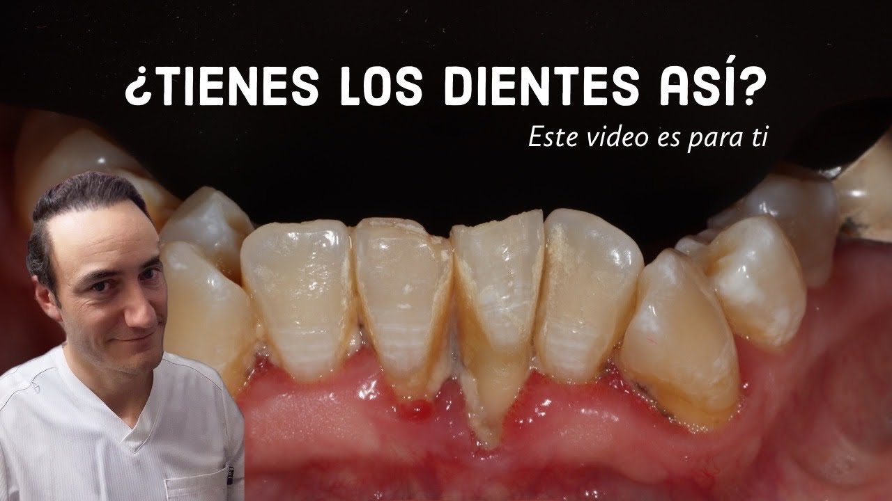 vale la pena la ortodoncia en adultos