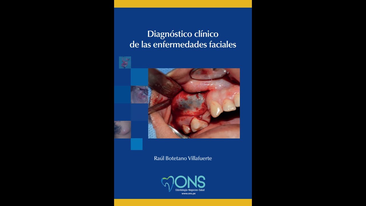alergia a la pasta de dientes