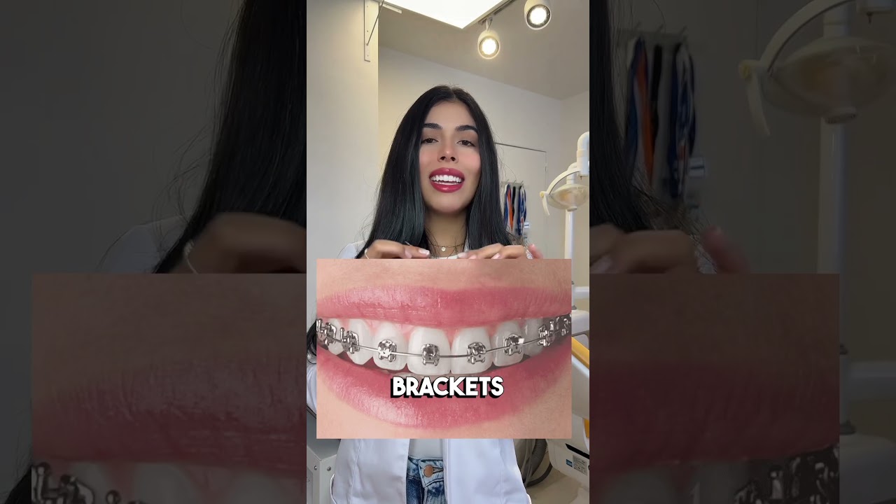 color de brackets para mujeres blancas