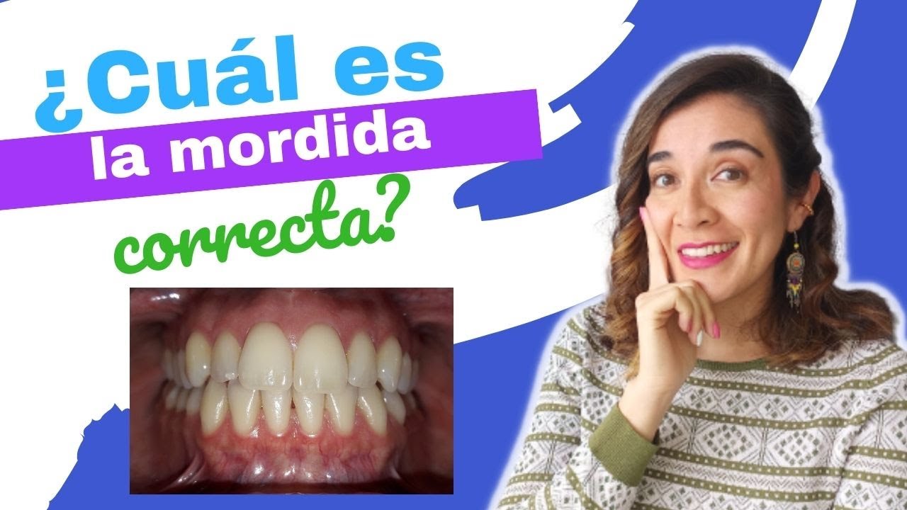 como debe ser la mordida perfecta