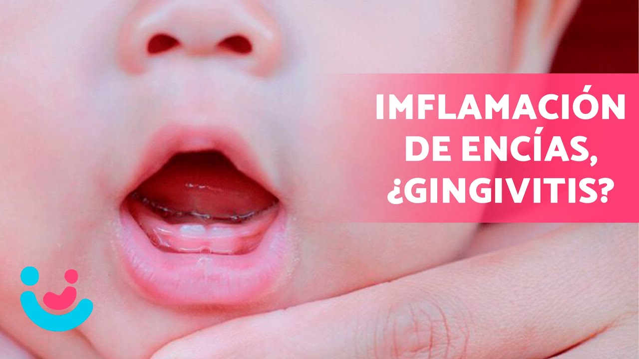 como se ven las encias inflamadas de un bebe