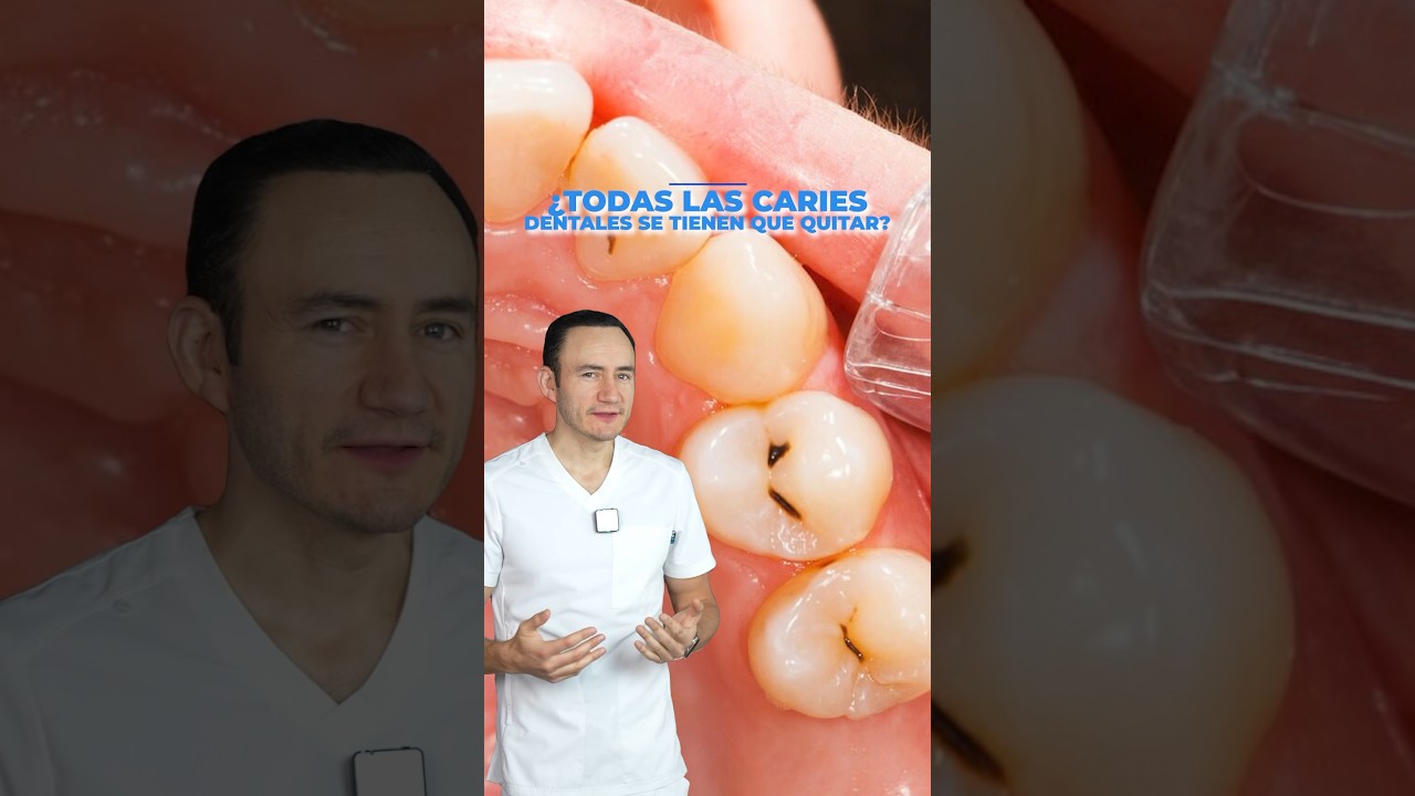 con que se quitan las caries de los dientes