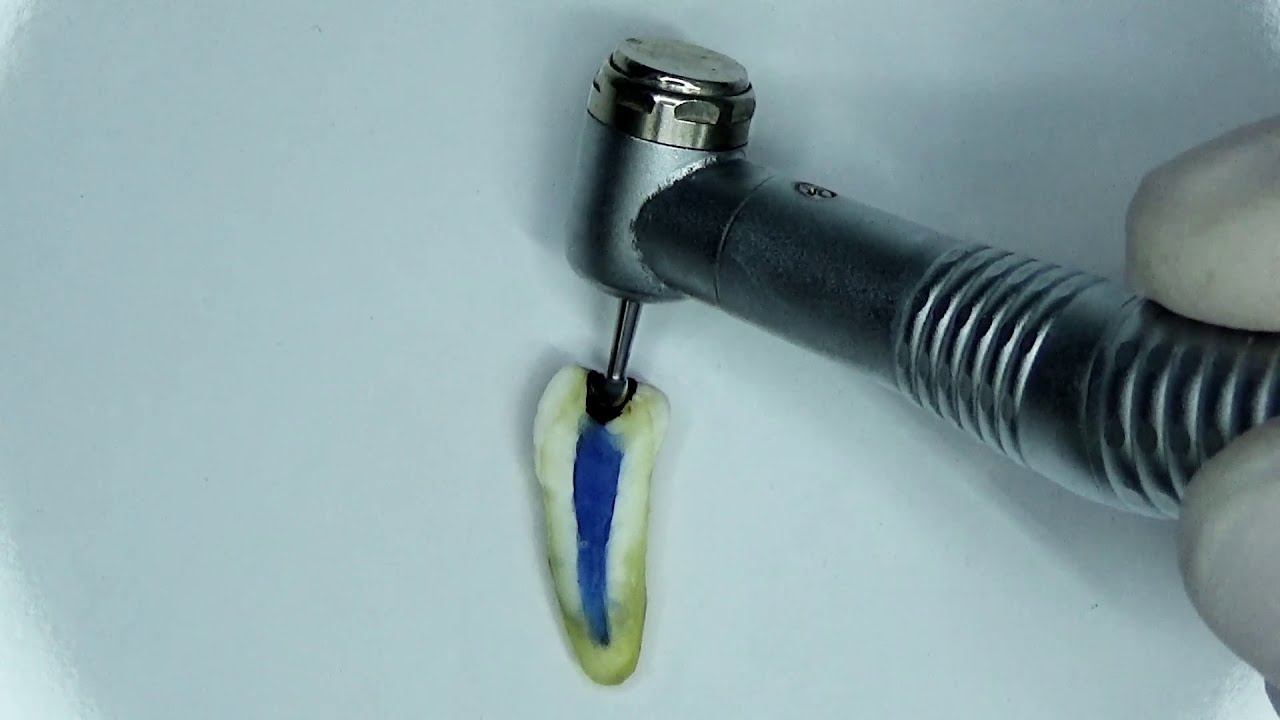 costo de una pulpotomia en niños
