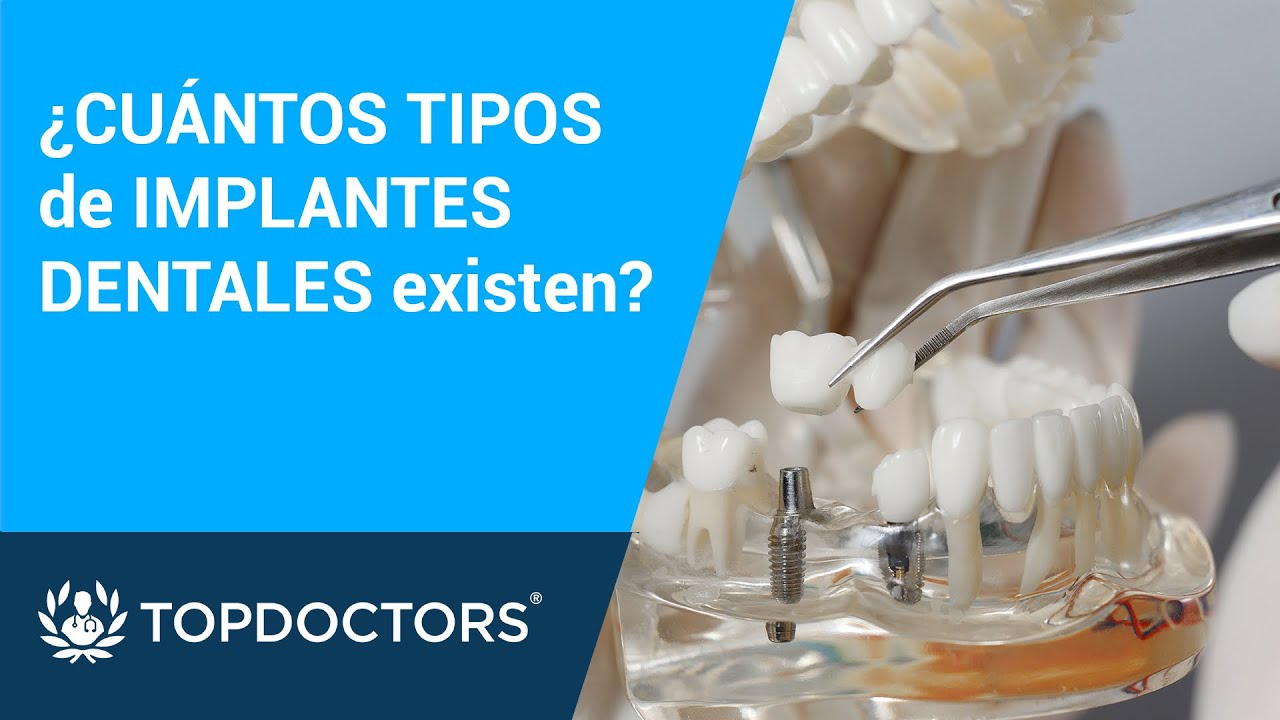 cuales son los tres tipos de implantes dentales