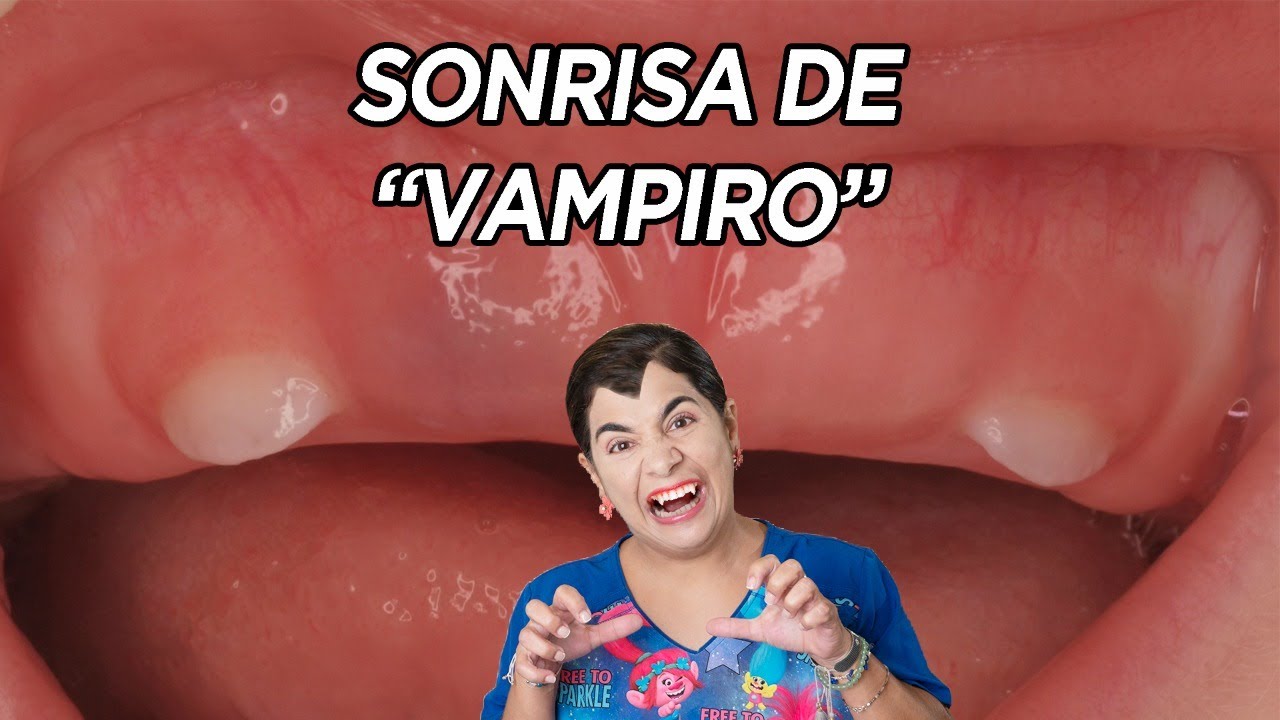 cuando salen los colmillos a los bebés