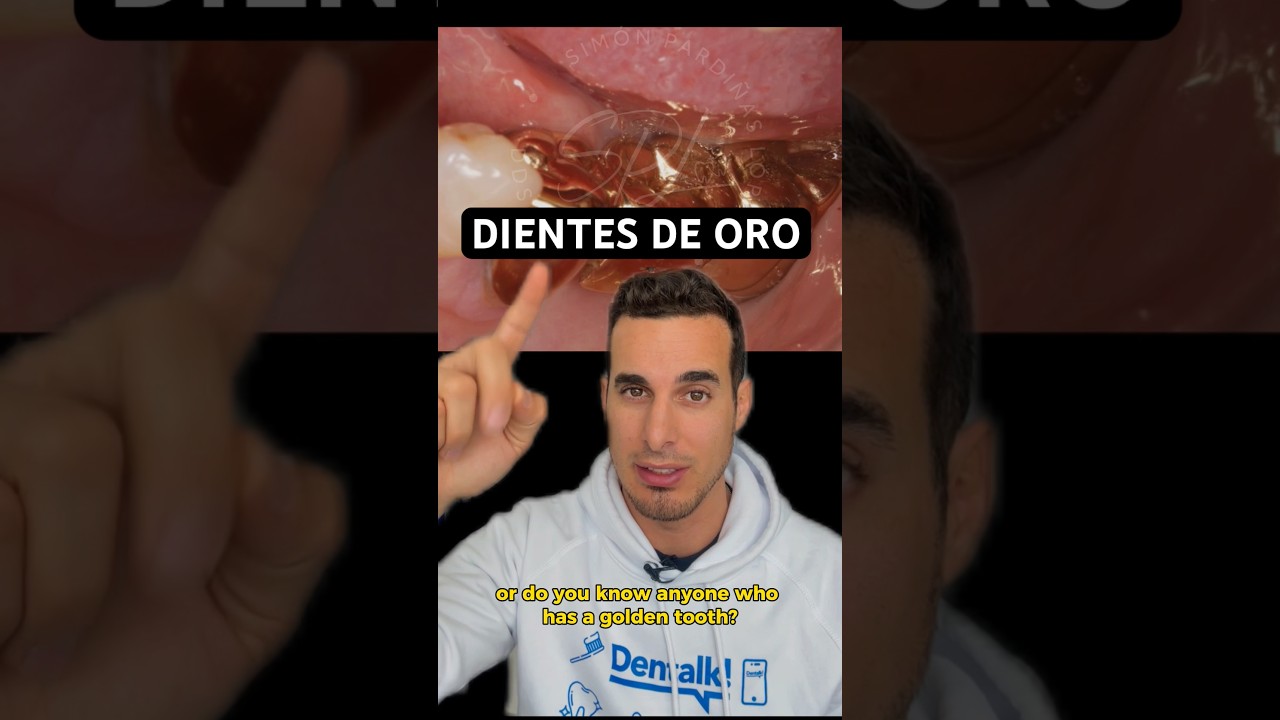 cuanto cuesta ponerse dientes de oro