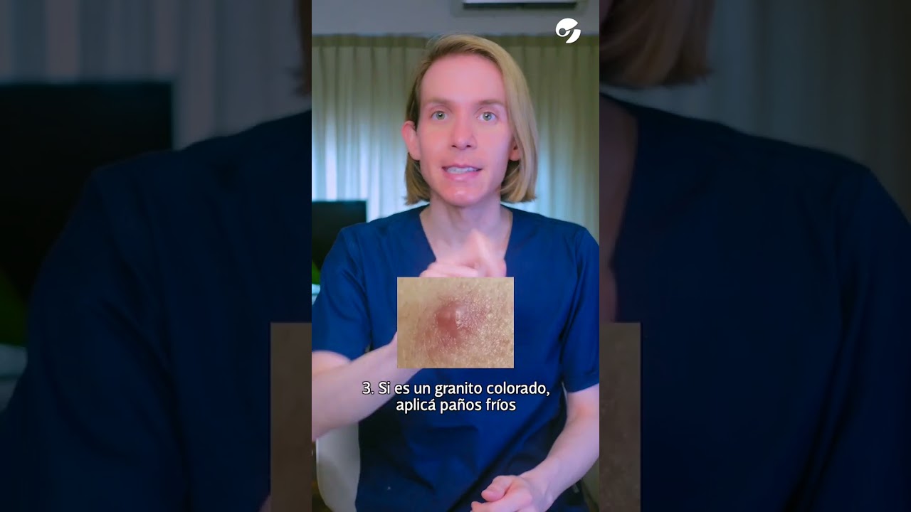 cuanto tarda en desinflamar un grano