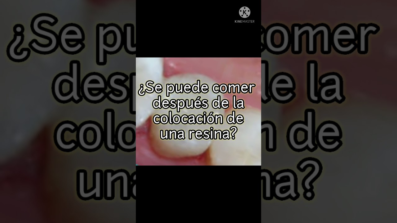 cuánto tiempo debe pasar para comer después de un empaste