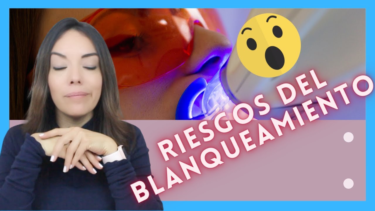 en que consiste el blanqueamiento dental