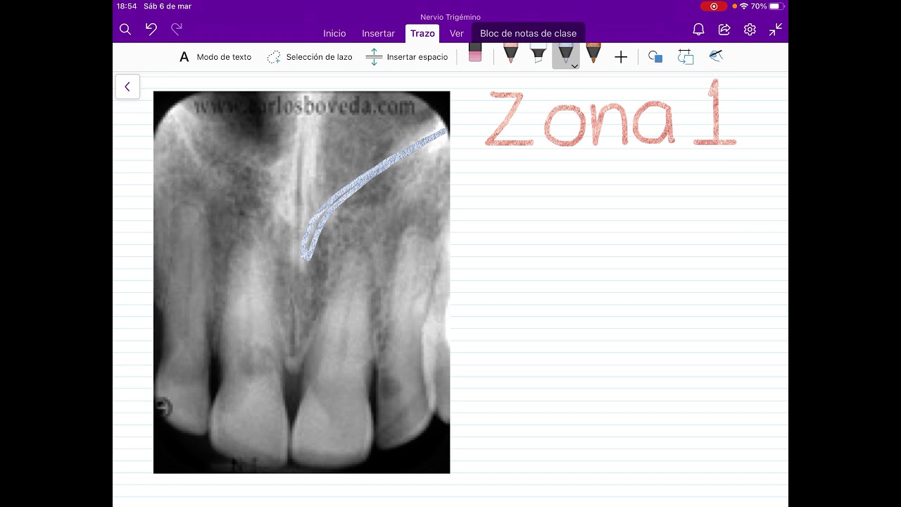 estructuras anatomicas en una radiografia periapical