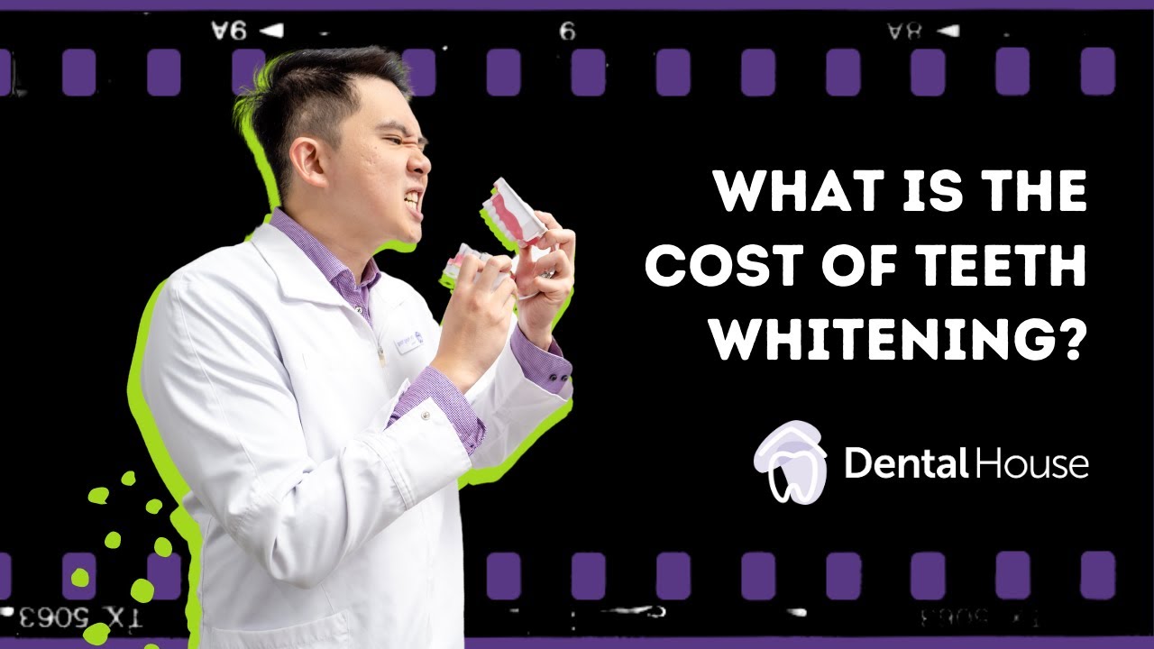 how much does white teeth cost