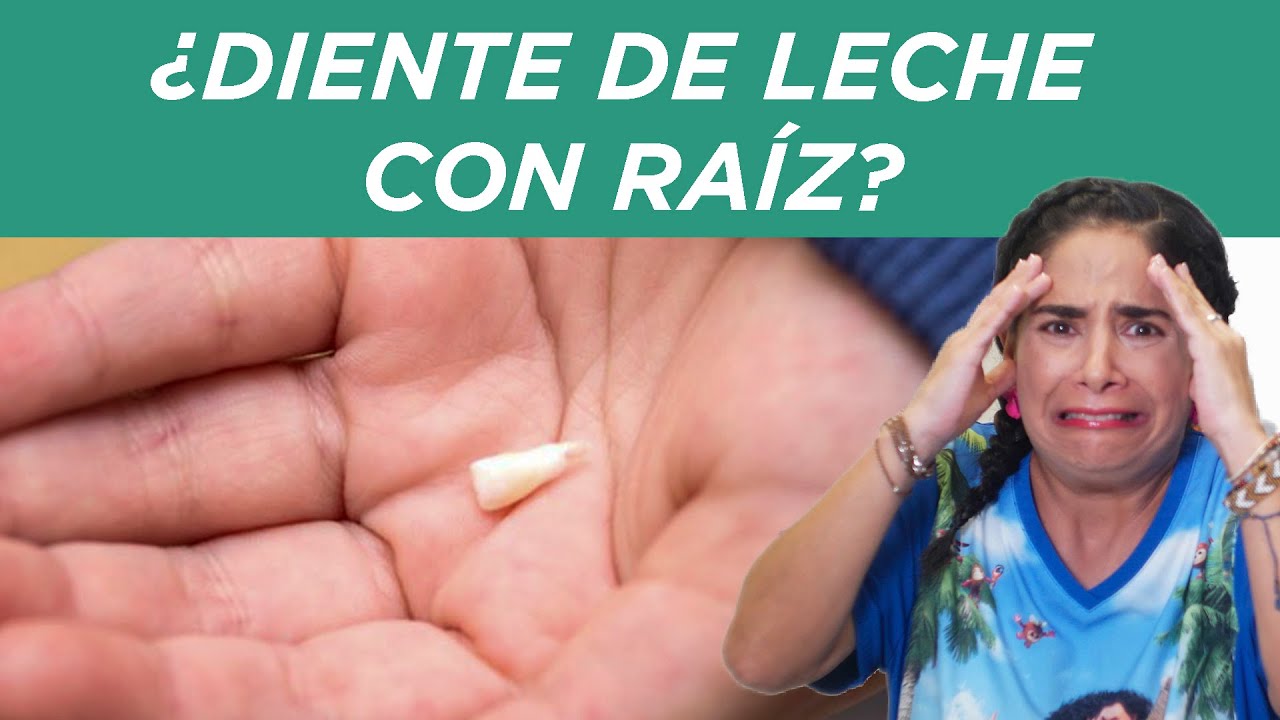 los dientes de leche tienen raiz