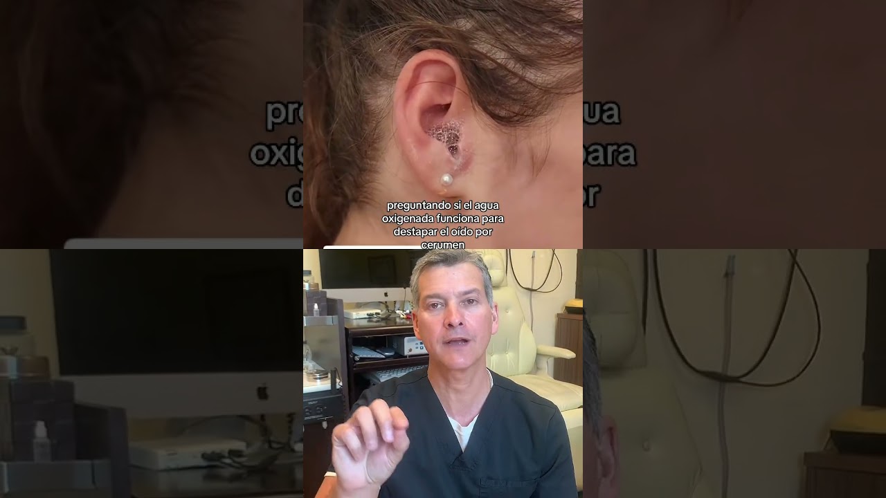 me eche agua oxigenada en el oido y me duele